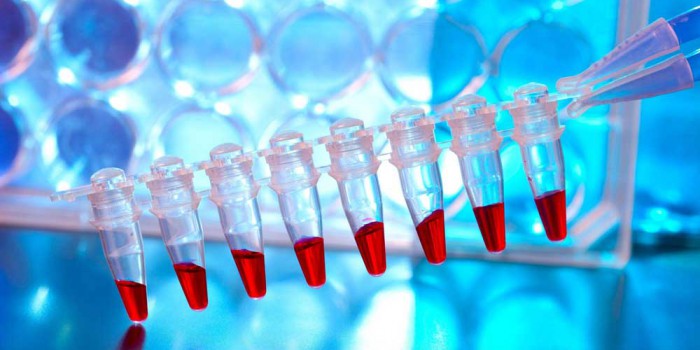 biomarker discovery